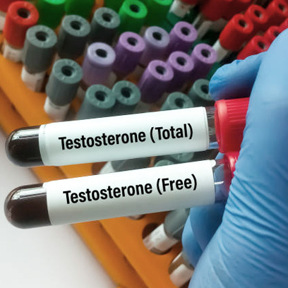 Scientist hold test tubes with blood sample for Testosterone (Total and -Free) test. Healthcare or medical concept. Sex hormone.