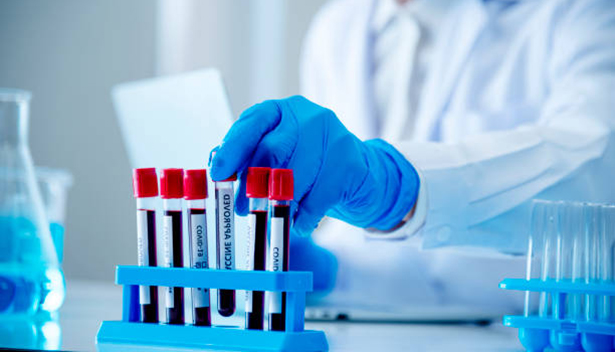 Scientist man holding sample blood test tube in science laboratory. Doctor clinic healthcare technician lab testing blood sample diagnosis. Asian man scientist working in hiv testing medical lab.